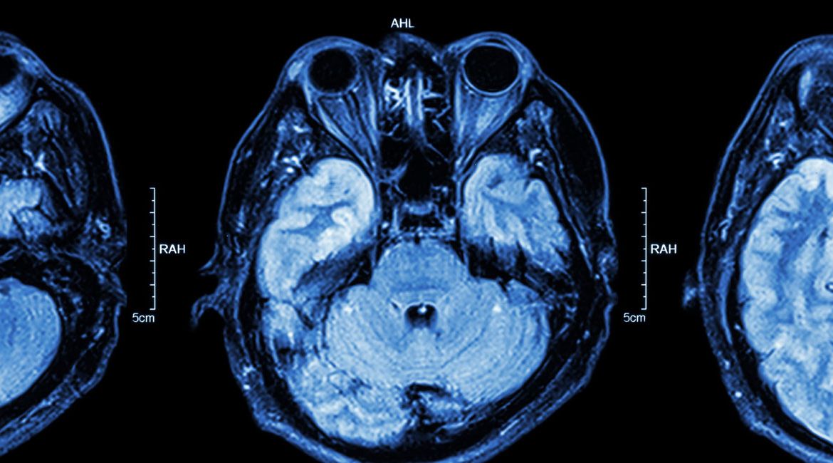 Neurosurgery